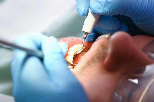 Best Emergency Broken Tooth Repair in Muscle Shos, AL